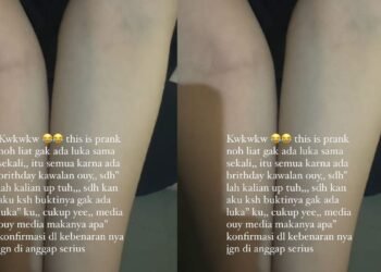Viral Mengaku Dianiaya Oknum Anggota DPRD, Winda Camay Minta Maaf : Ini Prank Saja Mas